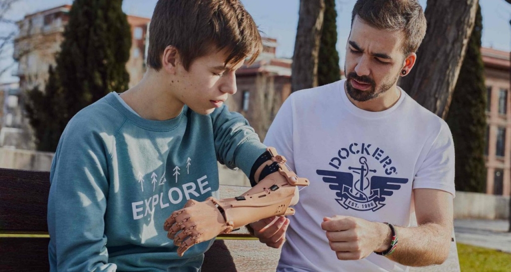 A person with a 3D prosthesis on the arm